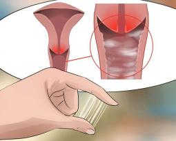 khi-hu-ra-nhieu-ngua-ngay-du-doi-canh-bao-benh-nguy-hiem