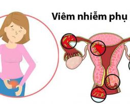 nhung-chi-em-bi-viem-nhiem-phu-khoa-muon-chua-khoi-dut-diem-tim-hieu-chi-tiet-tai-day